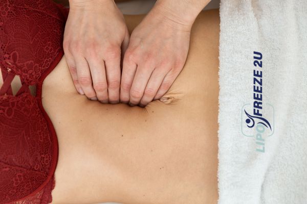 diastasis recti treatment Middlewich