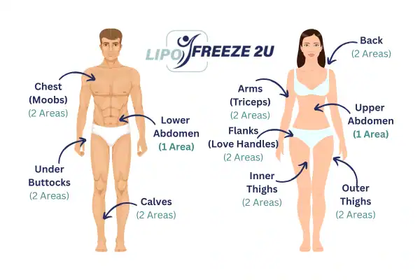 Areas you can have fat freezing treatment Middlewich