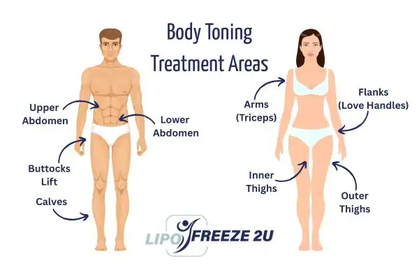 Graphic showing where you can have Body toning Treatment Middlewich on your body