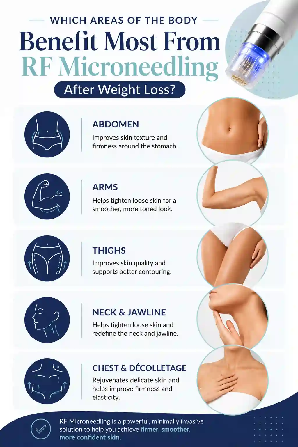 Which Areas of the Body Benefit Most From RF Microneedling After Weight Loss Middlewich