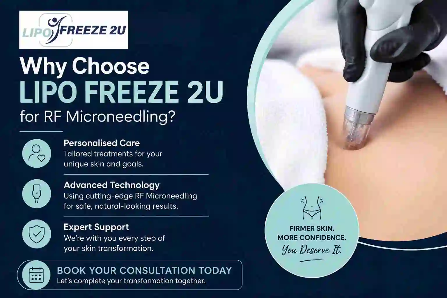 Why Choose LIPO FREEZE 2U for RF Microneedling Middlewich?